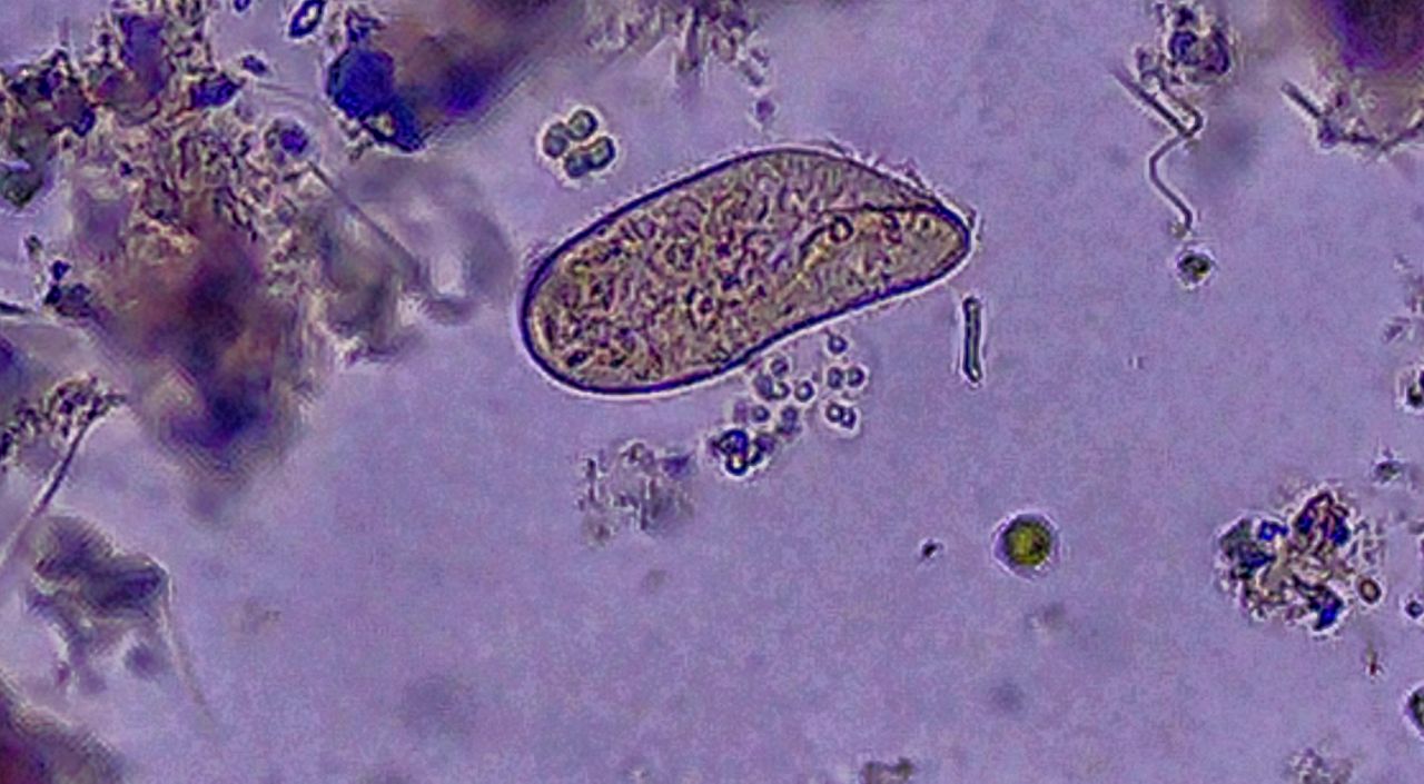 Il paramecio, il gigante dei Ciliati